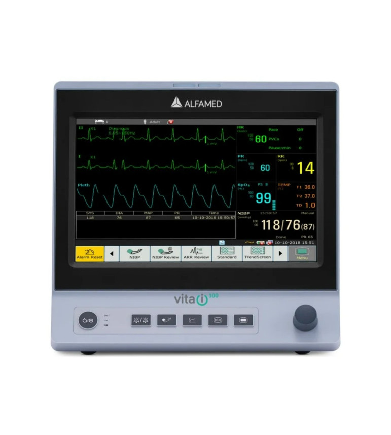 Monitor Multiparamétrico (Básico) VITA i100 Tela de 10.1″ - Alfamed